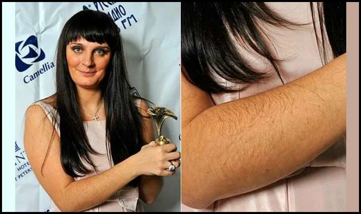 Այսպես էլ կլինի: Աստղային գեղեցկուհիների լուսանկարներ, ովքեր հանդես են գալիս հանուն բնականության