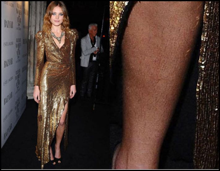 Այսպես էլ կլինի: Աստղային գեղեցկուհիների լուսանկարներ, ովքեր հանդես են գալիս հանուն բնականության