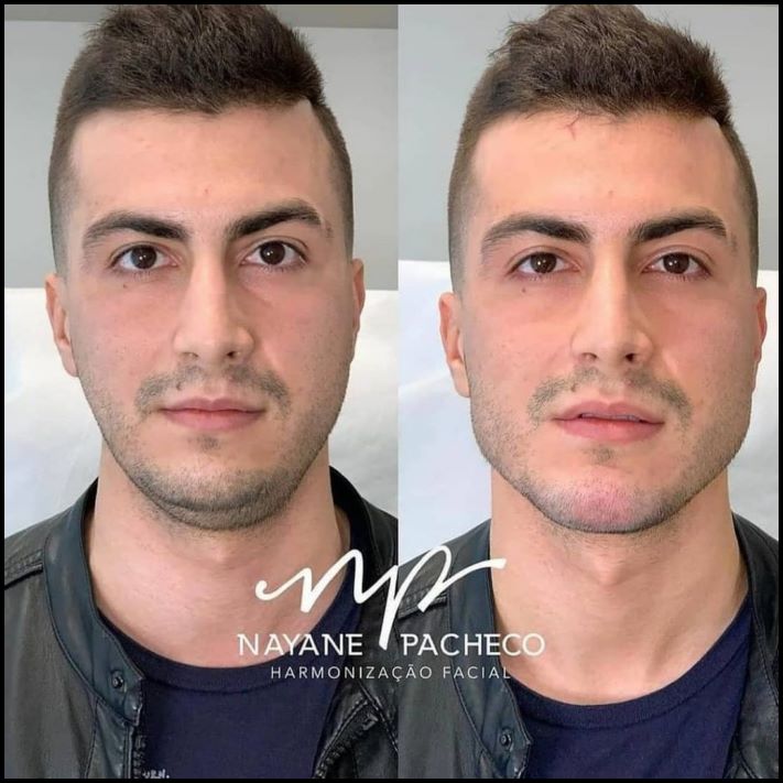 9 օրինակ, թե ինչպես են պլաստիկն ու կոսմետոլոգիան մարդկանց ավելի լավ տեսք հաղորդում