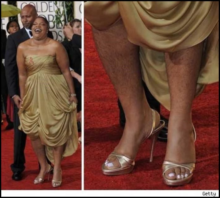 Այսպես էլ կլինի: Աստղային գեղեցկուհիների լուսանկարներ, ովքեր հանդես են գալիս հանուն բնականության