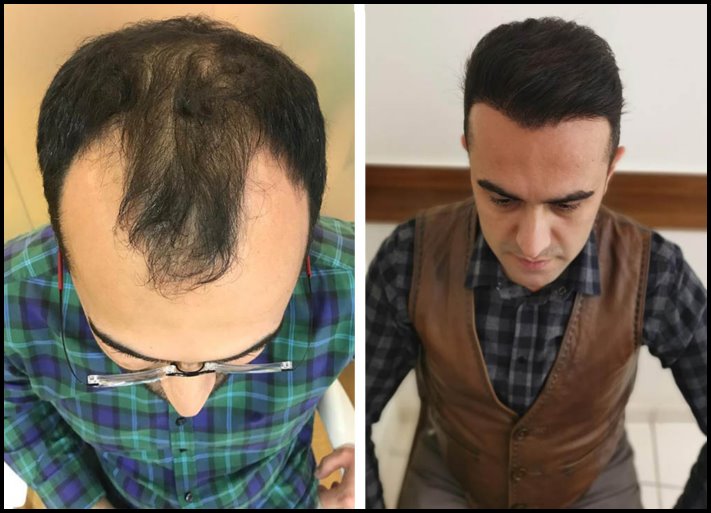 Իրական առաջընթացը ցույց տալու 16 հետաքրքրաշարժ համեմատություններ
