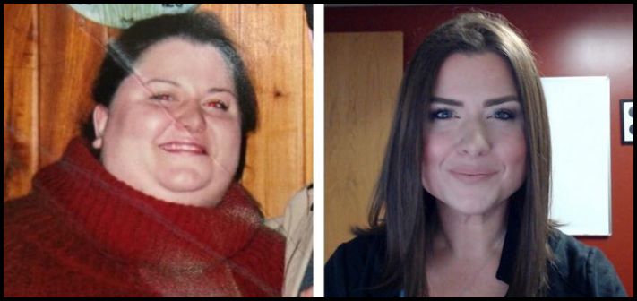20 լուսանկար, թե ինչպես են փոխվել մարդկանց դեմքերն անճանաչելիության աստիճան` քաշը կորցնելուց հետո