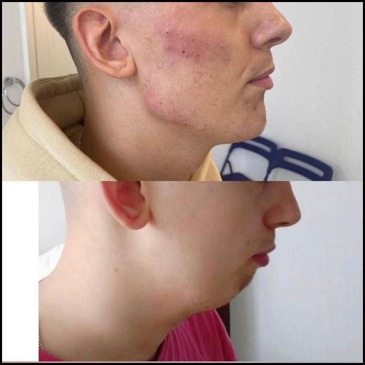 9 լուսանկար, որոնք ապացուցում են, որ բոտոքսն ու ֆիլլերը կարող են մարդկանց ավելի գեղեցիկ դարձնել