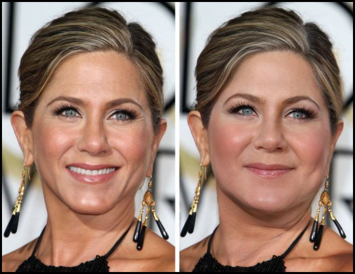 Ի՞նչ տեսք կարող են ունենալ համաշխարհային մակարդակի 11 աստղերը, եթե մի քանի կիլոգրամով գիրանային