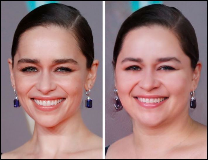 Ի՞նչ տեսք կարող են ունենալ համաշխարհային մակարդակի 11 աստղերը, եթե մի քանի կիլոգրամով գիրանային