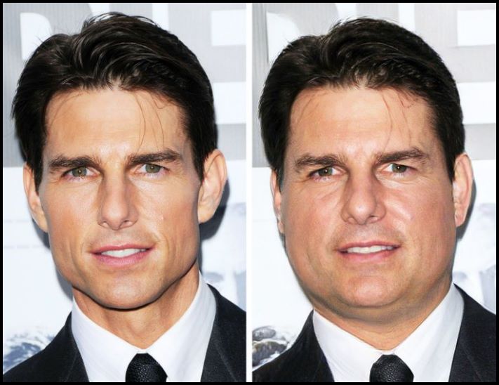 Ի՞նչ տեսք կարող են ունենալ համաշխարհային մակարդակի 11 աստղերը, եթե մի քանի կիլոգրամով գիրանային