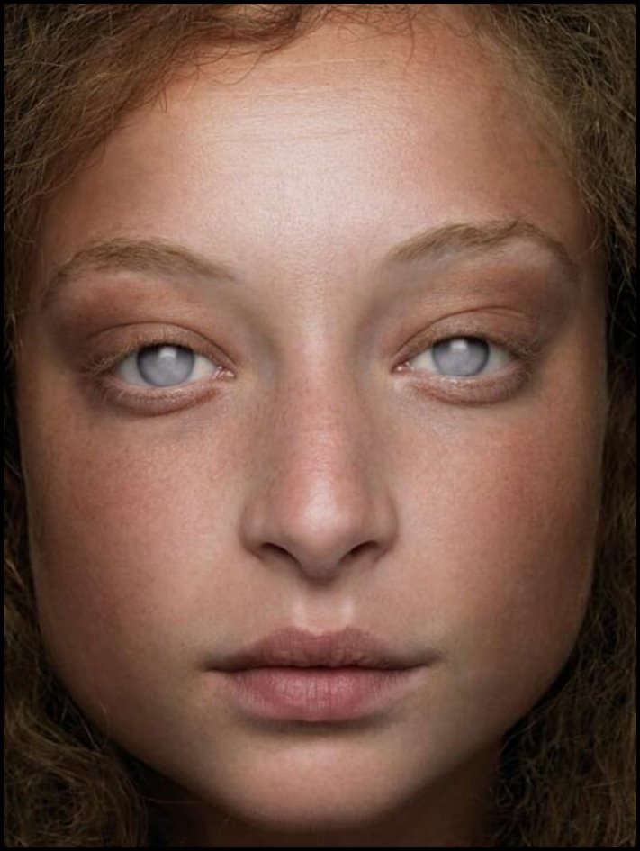 Անսովոր մարդկանց 19 օրինակ, ովքեր նման տեսք են ստացել գենետիկ մուտացիաների պատճառով