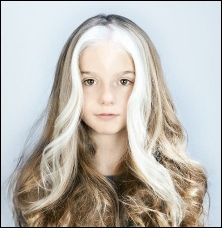 Անսովոր մարդկանց 19 օրինակ, ովքեր նման տեսք են ստացել գենետիկ մուտացիաների պատճառով