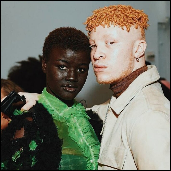 Անսովոր մարդկանց 19 օրինակ, ովքեր նման տեսք են ստացել գենետիկ մուտացիաների պատճառով