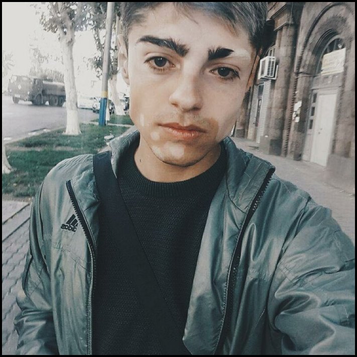 Անսովոր մարդկանց 19 օրինակ, ովքեր նման տեսք են ստացել գենետիկ մուտացիաների պատճառով