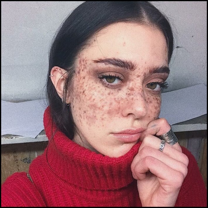 Անսովոր մարդկանց 19 օրինակ, ովքեր նման տեսք են ստացել գենետիկ մուտացիաների պատճառով