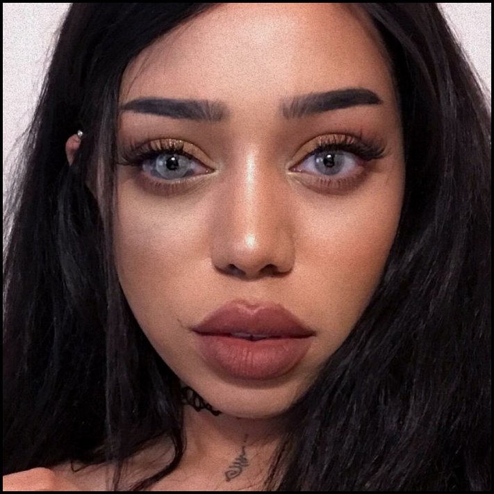 Անսովոր մարդկանց 19 օրինակ, ովքեր նման տեսք են ստացել գենետիկ մուտացիաների պատճառով