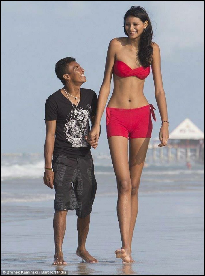 Անսովոր մարդկանց 19 օրինակ, ովքեր նման տեսք են ստացել գենետիկ մուտացիաների պատճառով