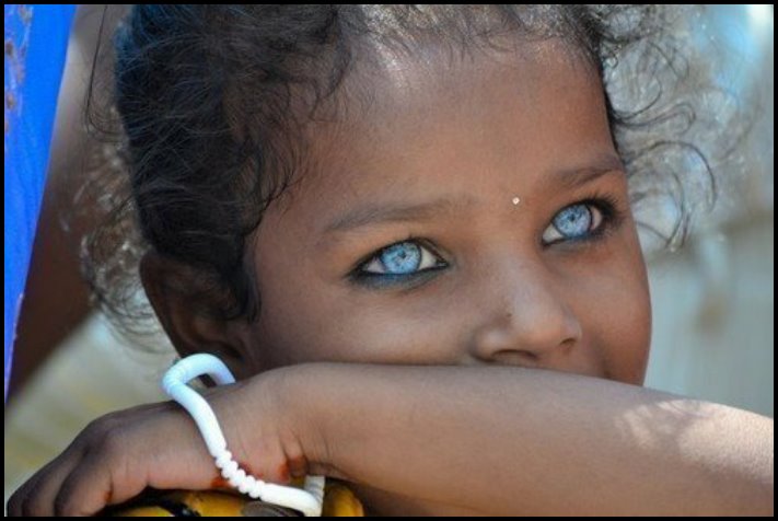 Անսովոր մարդկանց 19 օրինակ, ովքեր նման տեսք են ստացել գենետիկ մուտացիաների պատճառով