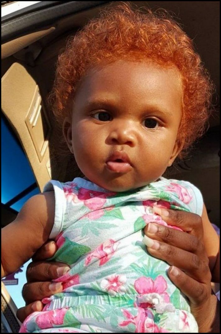 Անսովոր մարդկանց 19 օրինակ, ովքեր նման տեսք են ստացել գենետիկ մուտացիաների պատճառով