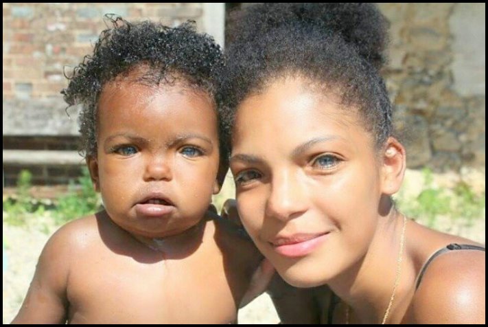 Անսովոր մարդկանց 19 օրինակ, ովքեր նման տեսք են ստացել գենետիկ մուտացիաների պատճառով