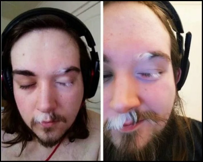 Անսովոր մարդկանց 19 օրինակ, ովքեր նման տեսք են ստացել գենետիկ մուտացիաների պատճառով