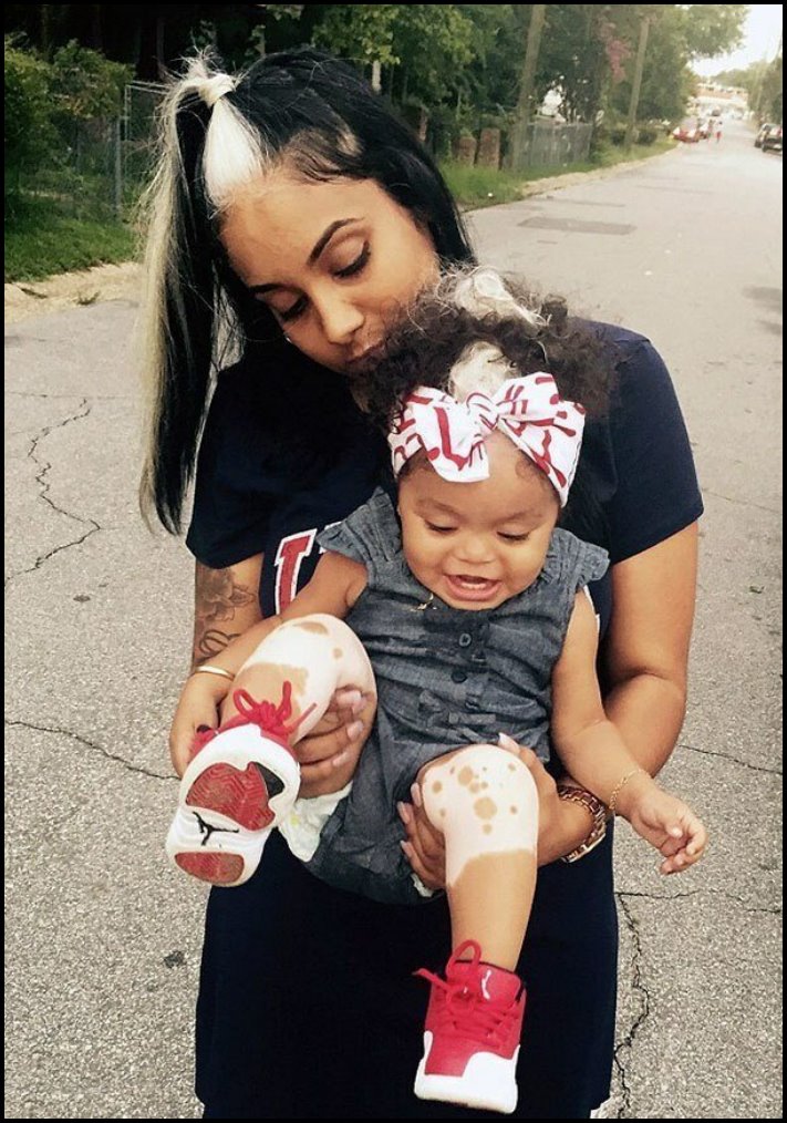 Անսովոր մարդկանց 19 օրինակ, ովքեր նման տեսք են ստացել գենետիկ մուտացիաների պատճառով