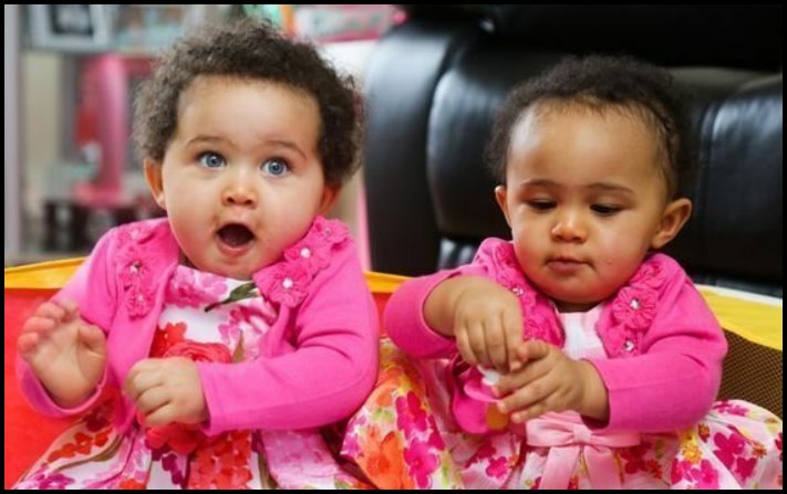 Անսովոր մարդկանց 19 օրինակ, ովքեր նման տեսք են ստացել գենետիկ մուտացիաների պատճառով