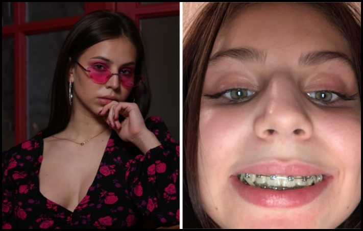 16 մարդ սոցիալական ցանցերից, ովքեր նկարներ են տեղադրել առանց մշակելու որևէ խմբագրում