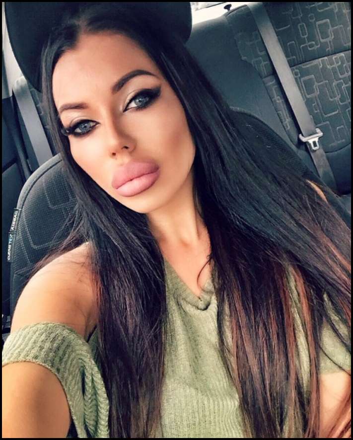 8 գեղեցկուհիներ, ովքեր չափն անցել են շուրթերի մեծացման հարցում