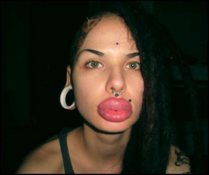 8 գեղեցկուհիներ, ովքեր չափն անցել են շուրթերի մեծացման հարցում