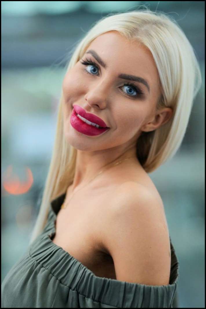 8 գեղեցկուհիներ, ովքեր չափն անցել են շուրթերի մեծացման հարցում