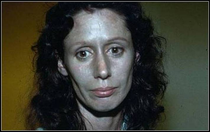 Հաշմանդամություն ունեցող 10 մարդ, որոնց նայելը սարսափելի է, բայց այնուամենայնիվ ուզում ես