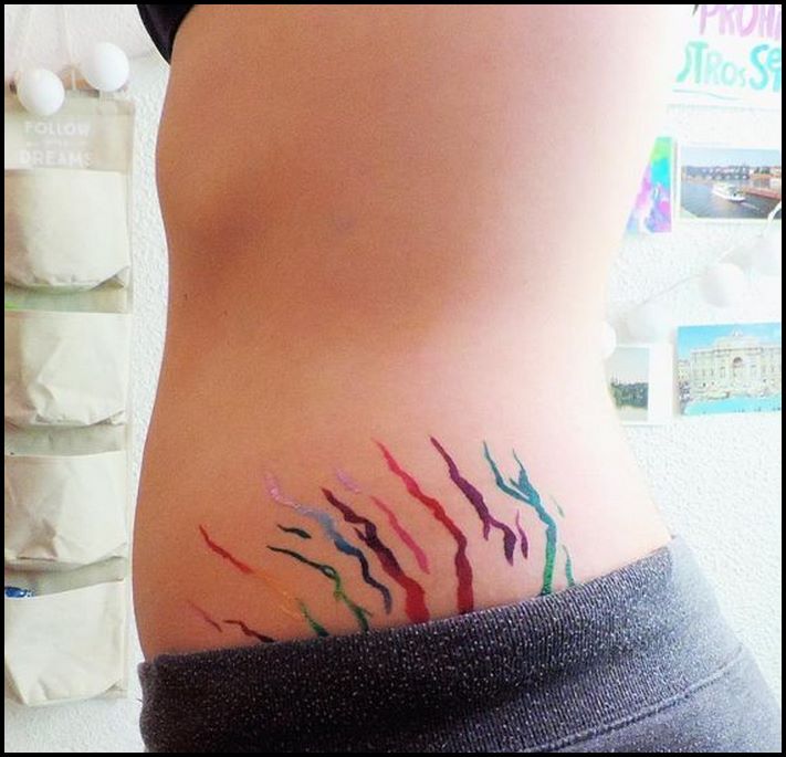 10 սպիեր, որոնք վերածվել են յուրահատուկ դաջվածքների