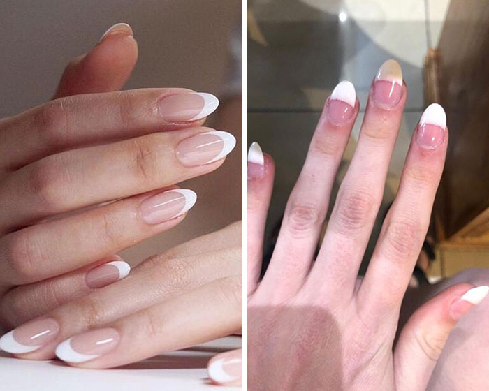 11 օրինակ, թե ինչպես են որոշ մասնագետներ մարդկանց վատ վերաբերվում