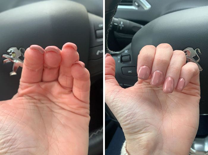 11 օրինակ, թե ինչպես են որոշ մասնագետներ մարդկանց վատ վերաբերվում