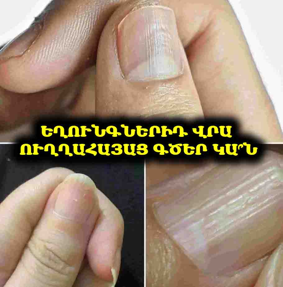 Եղունգներիդ վրա ուղղահայաց գծեր կա՞ն․ ահա ինչ են դրանք նշանակում իրականում
