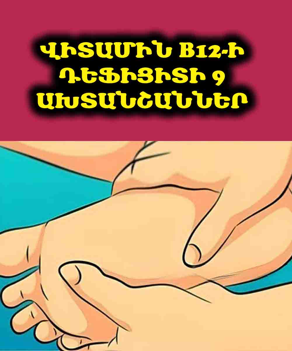 Չգիտես՝ ինչու ես թույլ, մոռացկոտ ու դյուրագրգիռ՞․ պատճառը կարող է B12-ի դեֆիցիտ լինել