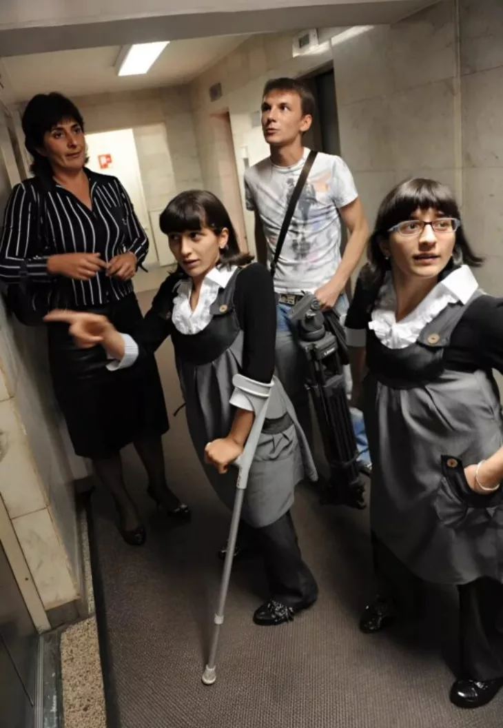 Քույրերը ծնվեցին կոնքի հատվածում միաձուլված, սակայն 11 տարեկանում բժիշկները հաջողությամբ բաժանեցին նրանց։ Ահա, թե ինչպիսի տեսք ունեն նրանք այսօր։