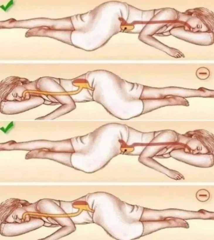 🛌💤 Ինչու՞ է ձախ կողքի վրա քնելը օգտակար առողջության համար