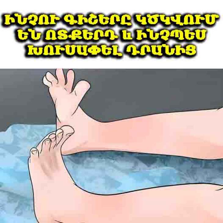 🦵 Գիշերային ցնցումները ոտքերում. ինչու են դրանք առաջանում և ինչպես դրանց դեմ պայքարել