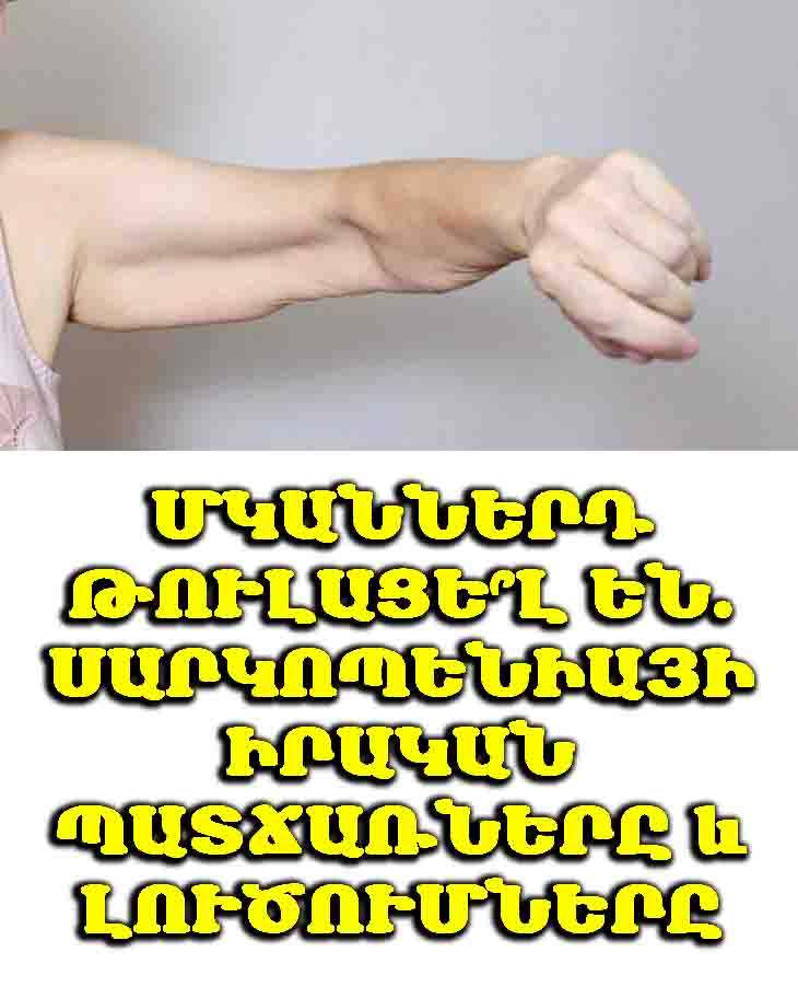 💪 Սարկոպենիա. ինչու ենք կորցնում մկանները և ինչպես վերականգնել դրանք