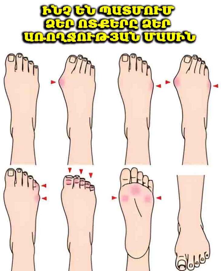 🦶 10 եղանակ, որոնցով ձեր ոտքերը նշաններ են տալիս ձեր առողջական վիճակի մասին