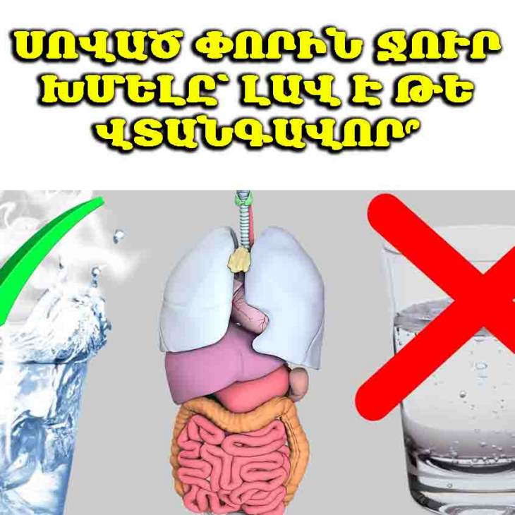 💧 Բժիշկը բացատրում է՝ ինչ ազդեցություն ունի սոված փորին ջուր խմելը