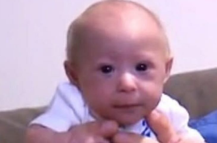👶 Նա 7 ամսական է, բայց տեսքով նորածին է թվում։ Այս փոքրիկի պատմությունը հայտնի դարձավ ամբողջ աշխարհում