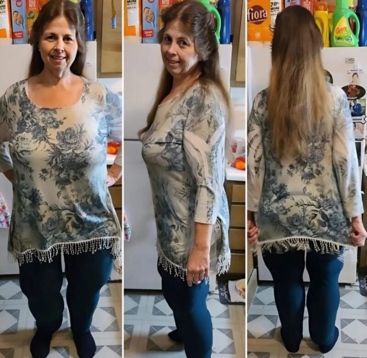 😱 Մի քանի տարի առաջ այս կինը կշռում էր գրեթե 320 կիլոգրամ, բայց նա շատ նիհարել է և դարձել անճանաչելի․ Ահա թե ինչ տեսք ունի այս կինն այսօր
