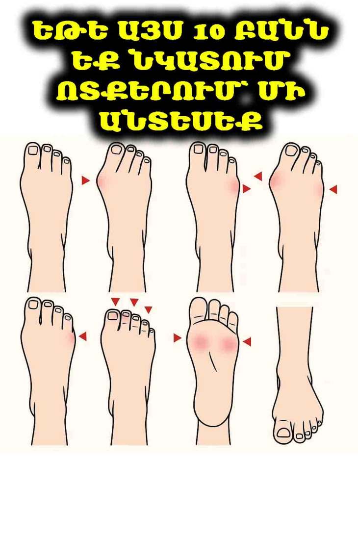 🦶 10 նշաններ, որոնց միջոցով ձեր ոտքերը ազդարարում են ձեր առողջական վիճակի մասին