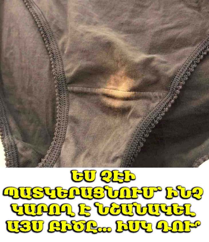 Եթե ձեր ներքնազգեստի վրա 👙 նկատում եք «գունազրկված» բիծ, լավ կլինի իմանաք՝ դա ինչ է նշանակում... 🤯 Ես անգամ չէի պատկերացնում...