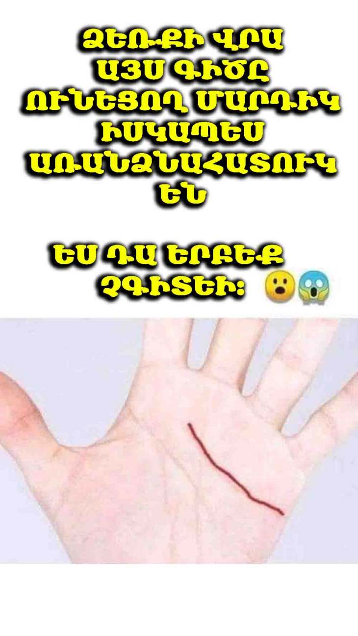 Ձեռքի վրա այս գիծը ունեցող մարդիկ իսկապես առանձնահատուկ են ✨🖐️։ Ես դա երբեք չգիտեի։