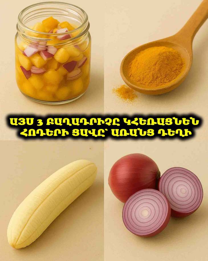 🍌🧅✨ Բնական միջոց հոդերի և ոսկորների ցավի համար՝ բանան, սոխ և քրքում