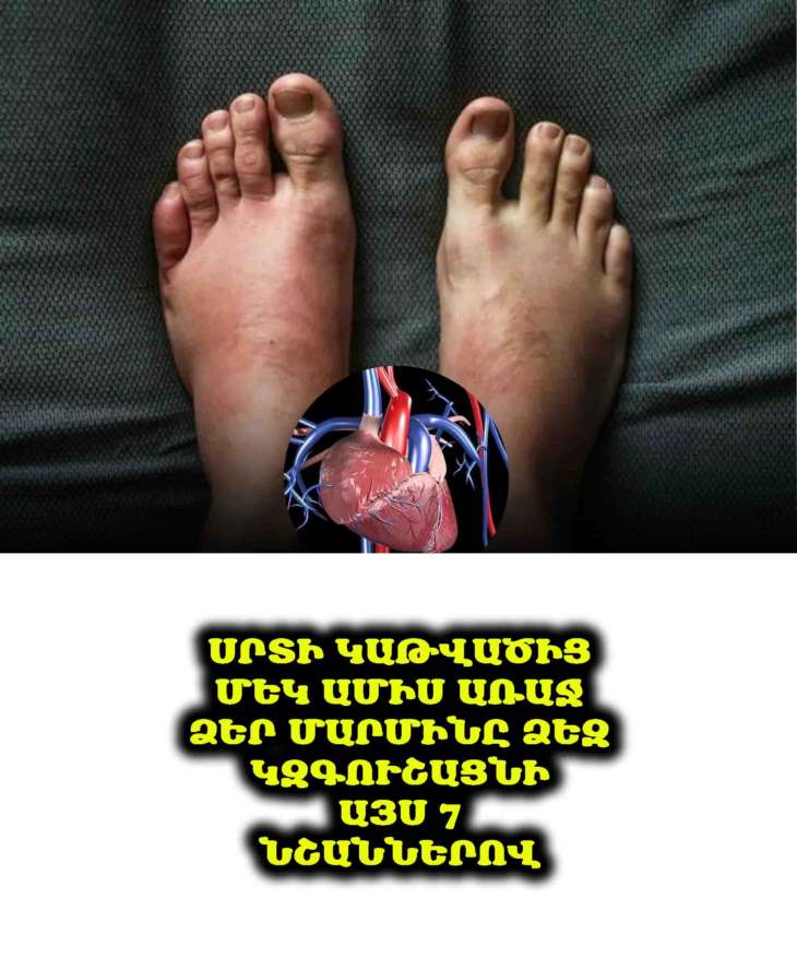 ❤️ Սրտի կաթվածից մեկ ամիս առաջ ձեր մարմինը ձեզ կզգուշացնի այս 7 նշաններով