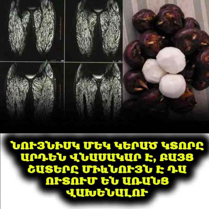 ⚠️ Մեկ հատ օգտագործելը համարժեք է օրգանիզմում 100 000 մակաբույծի հայտնվելուն․ շատ մարդիկ ուշադրություն չեն դարձնում և պարզապես ուտում են դա