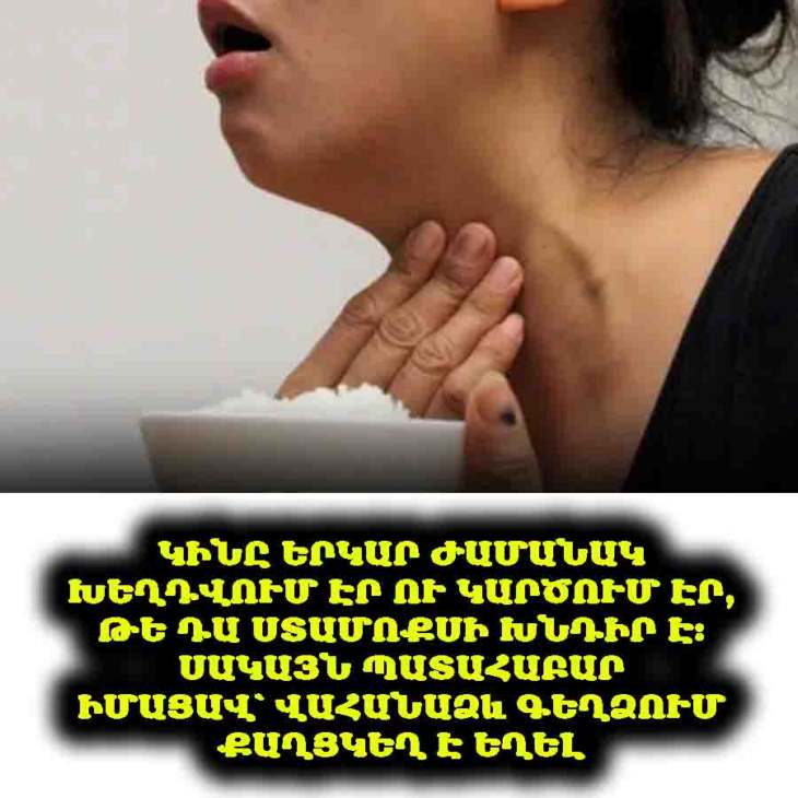 😨 Կինն ունի երկարատև խեղդող զգացողություն։ Սկզբում կարծում էին, թե դա ստամոքսից է, բայց պարզվեց՝ վահանաձև գեղձի քաղցկեղ էր