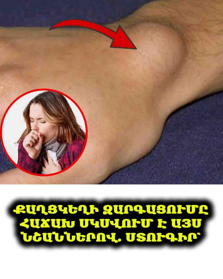 ⚠️ 6 նախազգուշացնող նշան, որ մարմինդ կարող է զարգացնել քաղցկեղ – թիվ 1 նշանը, որ հաճախ անտեսվում է
