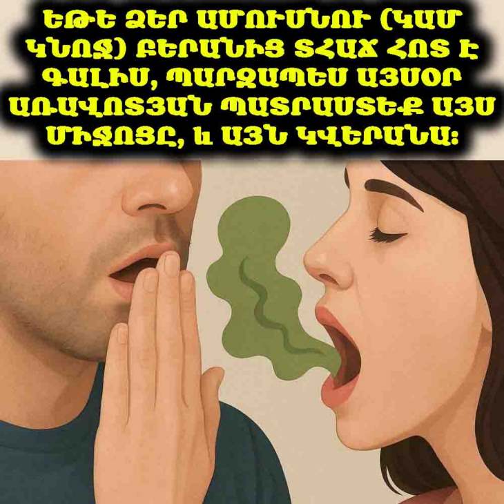 😷 Ինչպես վերացնել բերանի տհաճ հոտը․ եթե ձեր բերանում առկա է սա, ապա հնարավոր է՝ ունեք այս տեսակի բակտերիաներ